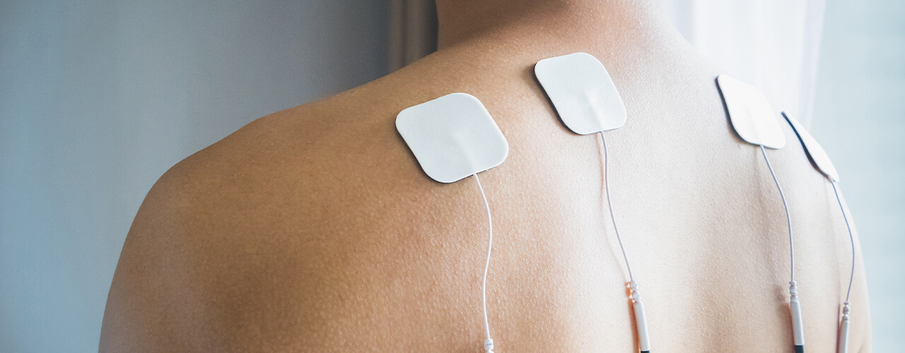 Electrical Stimulation