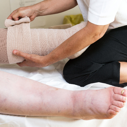 lymphedema-relief-pelham-physical-medicine-bronx-ny